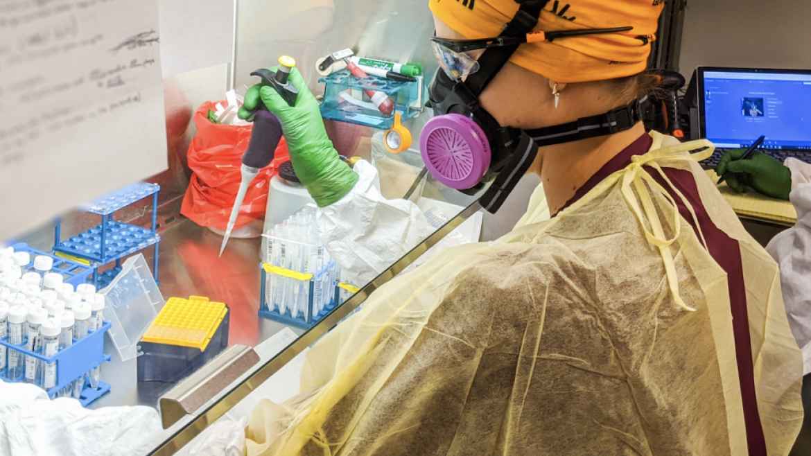 Asu开发了利用唾液进行新冠检测的技术 美国亚利桑那州立大学asu官网